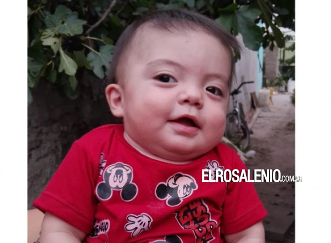 Liam va a tener su casco ortopédico