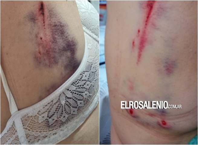 Grünbein: feroz ataque de un dogo a una jubilada