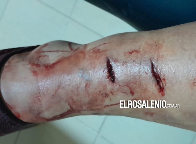 Dos perros hirieron a una mujer frente a la municipalidad