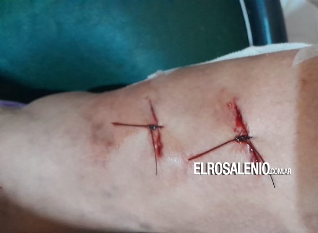 Dos perros hirieron a una mujer frente a la municipalidad