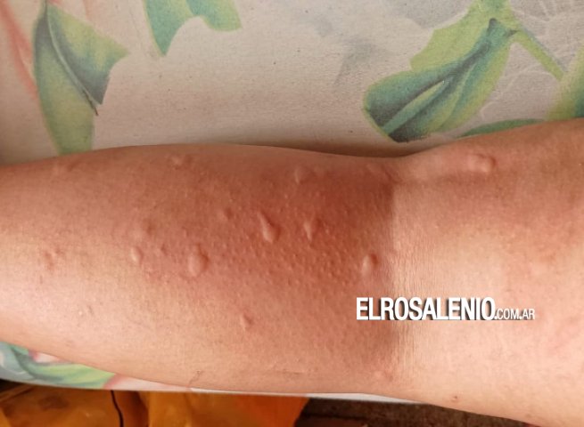 Fotos de los lectores: invasión de mosquitos en la ciudad