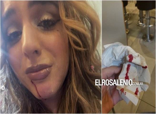 Denuncia que le pegaron por ser trans