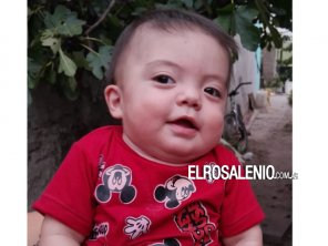 Liam va a tener su casco ortopédico