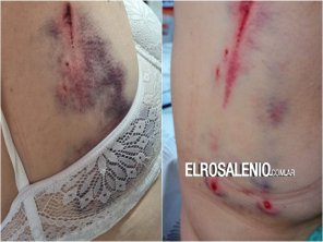 Grünbein: feroz ataque de un dogo a una jubilada