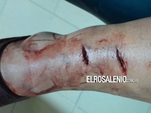 Dos perros hirieron a una mujer frente a la municipalidad