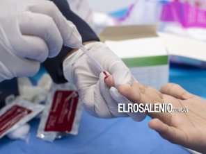 El 45% de los nuevos diagnósticos de VIH son tardíos, según datos oficiales 