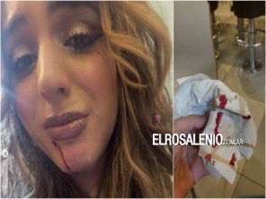 Denuncia que le pegaron por ser trans